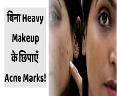 बिना Heavy Makeup के छिपाएँ Acne Marks! | ABP Uncut Beauty