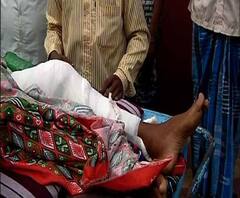 এবিপি আনন্দের খবরের জের, ৩০ ঘণ্টা পরে হাসপাতালে জায়গা পেল কিশোর