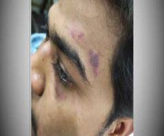 Reporter Stories: মেডিক্যাল কলেজে নিরাপত্তারক্ষীর হাতেই প্রহৃত জুনিয়র চিকিৎসক! প্রতিবাদে দু’ঘণ্টা কর্মবিরতি