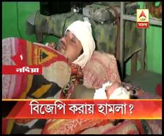 নদিয়ার চাকদায় বিজেপি করায় বাবা-ছেলেকে খুনের চেষ্টার অভিযোগ তৃণমূল কর্মীর বিরুদ্ধে