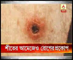 শীতের আমেজ, তারপরও কমছে না রোগভোগ, চিন্তায় চিকিত্‍সকরা