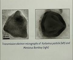 Megavirus in Water | मुंबईतील जलाशयात आढळला महाकाय विषाणू, विषाणूचा आरोग्याला धोका नसल्याचं शास्त्रज्ञांचं मत | ABP Majha