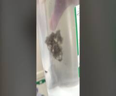 Beed Civil Hospital | सलाईनच्या बाटलीत शेवाळ, बीड जिल्हा रुग्णालयातील धक्कादायक प्रकार उघडकीस | ABP Majha