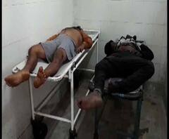 Reporter Stories: কাঁথিতে দুই পথচারীকে গাড়ির ধাক্কা, হাসপাতালে মৃত্যু, ঘাতক গাড়ির খোঁজে চলছে তল্লাশি