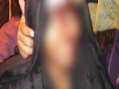 Delhi: JNU में बवाल, नकाबपोश हमलावरों ने छात्रसंघ अध्यक्ष आईशी घोष को पीटा, तोड़फोड़ भी की