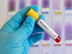 નવસારીઃ રાજ્યમાં પ્રથમ વખત નોંધાયો મિલઓઇડોસિસ નામના રોગનો કેસ