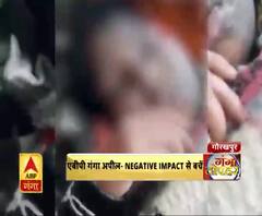 फिल्म 'छपाक' का नकारात्मक प्रभाव