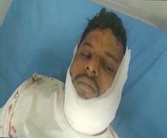 Train Accident | कळवा-मुंब्रा दरम्यान लोककलमधून पडून एका तरुणाचा मृत्यू, दोन जण गंभीर