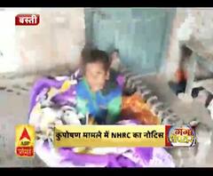 कुपोषण मामले में NHRC का नोटिस