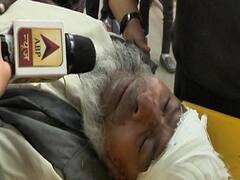 Delhi Violence: घायलों को GTB Hospital में किया गया भर्ती