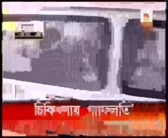 চিকিৎসার গাফিলতির অভিযোগ এসএসকেএম হাসপাতালের বিরুদ্ধে