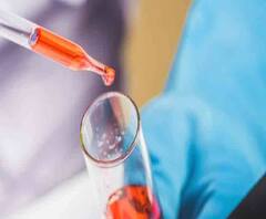 করোনা ও সোয়াই ফ্লু-র পার্থক্য কী? কীভাবে বুঝবেন আপনি কোন রোগে আক্রান্ত? 