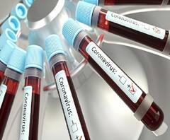 #CoronaVirus कोरोनाबाबत चंद्रपूर प्रशासनाच्या गांभीर्यतेवर प्रश्नचिन्ह, संशयित व्यक्ती दिल्लीला रवाना वैद्यकीय अधीक्षकांचा आरोप