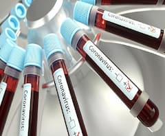 #Corona Threat | कोरोनाच्या भीतीने बाजारपेठांकडे ग्राहकांची पाठ, रंग खरेदीला थंड प्रतिसाद, व्यापारी चिंतेत 