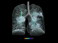 Coronavirus का शरीर पर क्या प्रभाव पड़ता है? देखिए इस रिपोर्ट में
