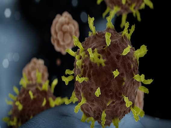 Number of Coronavirus positive cases cross 8 lakh mark in the world