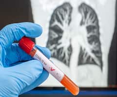 #Coronavirus Outbreak | कोरोनाचा जगभरात धुमाकूळ इटली, फ्रान्स, स्पेन, इराण, चीनमध्ये मृत्यूचं वाढतं प्रमाण