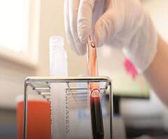 প্লাজমা থেরাপিতে সুস্থ হয়েছেন আক্রান্ত, দাবি দিল্লির হাসপাতালের