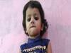 Delhi: 5-year-old dies due to hospitals' negligence