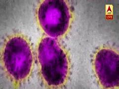 कोरोना वायरस है क्या? Hydroxychloroquine कितनी कारगर? जानिए इससे जुड़े कई सवालों के जवाब Dr. Benzeeta से