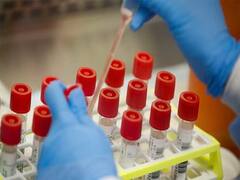 ગુજરાત સરકારનો મોટો નિર્ણય, કોરોનાના ટેસ્ટ માટે અપનાવશે આ રણનીતિ, જુઓ વીડિયો