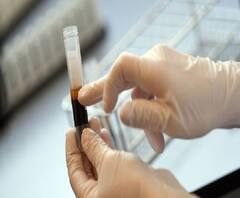 রাজ্যে এবার প্লাজমা থেরাপি, আইসিএমআর থেকে প্রাথমিক সবুজ সংকেত পেয়েছে অ্যাপোলো হাসপাতাল