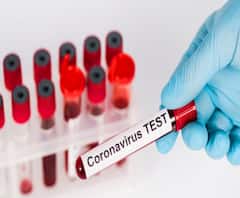 স্বাস্থ্যকর্মী ও চিকিৎসকদের অ্যান্টিবডি টেস্ট করানোর পরামর্শ দিলেন চিকিৎসক অমিতাভ নন্দী