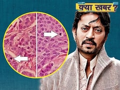 क्या है Neuroendocrine tumor जिस से जूझ रहे थे इरफान खान | ABP Uncut 