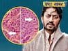 Irrfan Khan was suffering from a rare illness neuroendocrine tumor.  Find out more about it | ABP Uncut