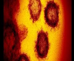 সংক্রমণ খুঁজতে কতটা জরুরি র‍্যাপিড টেস্ট, জানালেন চিকিৎসক সুপ্রিয় সরকার