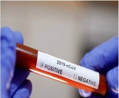 বর্ধমানে কোয়ারেন্টিনে চিকিৎসক-সহ ৩৮ জন স্বাস্থ্যকর্মী, আলিপুরদুয়ারে আক্রান্ত পুলিশ - দেখুন 'এক ঝলকে'