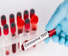 নজরে ৯টা: করোনায় বিশ্বে মৃতের সংখ্যা ছাড়াল ২ লক্ষ, মুখ্যমন্ত্রীর উদ্যোগে ঘরে ফিরলেন ৪৩ জন ও অন্যান্য খবর