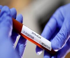 ভারতে করোনায় মৃত বেড়ে ৬৮, নিজামউদ্দিন থেকে সংক্রমণ ১৭ রাজ্যে, দাবি কেন্দ্রীয় স্বাস্থ্য মন্ত্রকের