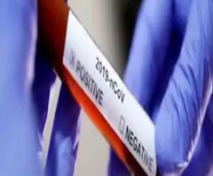 সরকারি হোক বা বেসরকারি ল্যাবরেটরি, নিখরচায় করোনা পরীক্ষা করার ব্যবস্থা করতে হবে, কেন্দ্রকে অন্তবর্তী নির্দেশ সুপ্রিম কোর্টের