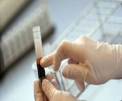 রাজ্যে আক্রান্তের শরীরে প্লাজমা থেরাপির প্রয়োগ শুরু 