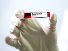 Special Report: कोरोना से समाज में फिर लौटा 'छूआछूत' !