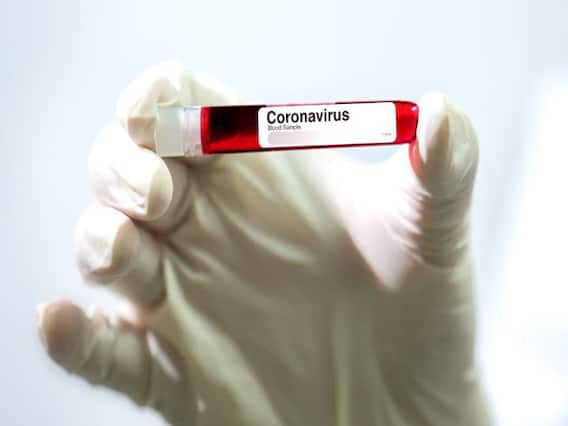 Special Report: कोरोना से समाज में फिर लौटा 'छूआछूत' !