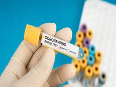 ED employee tests positive for Coronavirus