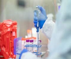 করোনা: বিশ্বে মৃত ৩ লক্ষ ৪৩ হাজারেরও বেশি মানুষ, আক্রান্ত ৫৪ লক্ষেরও বেশি