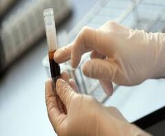  বিহারে ১৯০ জন পরিযায়ী শ্রমিক করোনা আক্রান্ত 