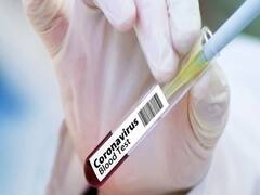 SpiceJet के विमान में मिले 2 कोरोना संक्रमित