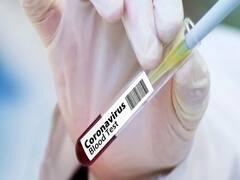 सितंबर तक आएगी कोरोना Vaccine, Biritsh pharma company ने किया दावा । Namaste Bharat Full