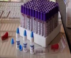 হাসপাতালে সিসিটিভি বসান, কোভিড টেস্টের খরচ হোক অভিন্ন- সুপ্রিম কোর্ট