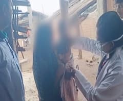 Melghat Superstition | मेळघाटात आई-वडिलांकडून आठ महिन्यांच्या बाळाच्या पोटावर गरम विळ्याचे चटके 