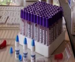 কলকাতায় ৩৯৬ জনের রক্তে আইজিজি পরীক্ষায় ৫৭ জন করোনা পজিটিভ, আইসিএমআরের রিপোর্টে উদ্বেগ