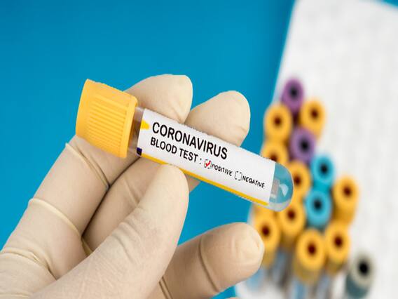 COVID 19: रूस ने कोरोना की दवा बनाने का किया दावा, परीक्षण का पहला चरण कामयाब