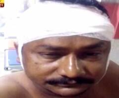 পূজালি পুরসভার তৃণমূল কাউন্সিলরকে কাটারির কোপ 