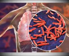 নজরে ৯টা: চিকিৎসকদের কপালে ভাঁজ ফেলছে যক্ষ্মা, সঙ্গে অন্য খবর চটজলদি