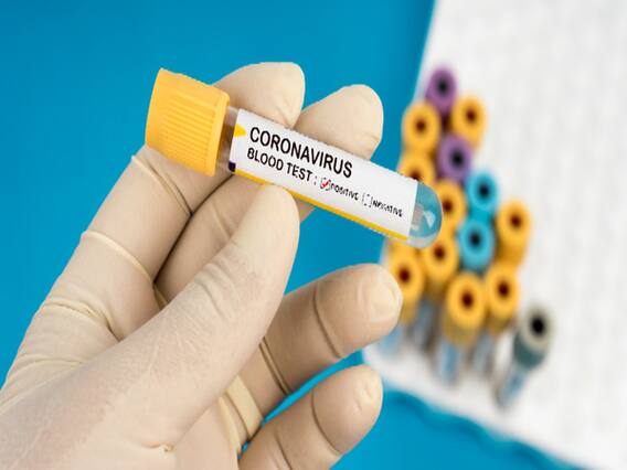 अमेरिका में कोरोना मामलों की संख्या 19 लाख के पार