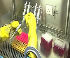 করোনা উপসর্গের তালিকায় নতুন সংযোজন ‘হঠাৎ স্বাদহীনতা’ ও ‘ঘ্রাণশক্তি হ্রাস’